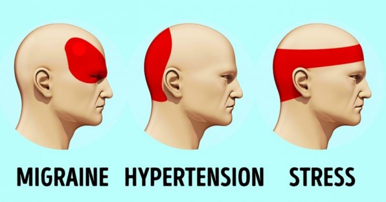 HEADACHE