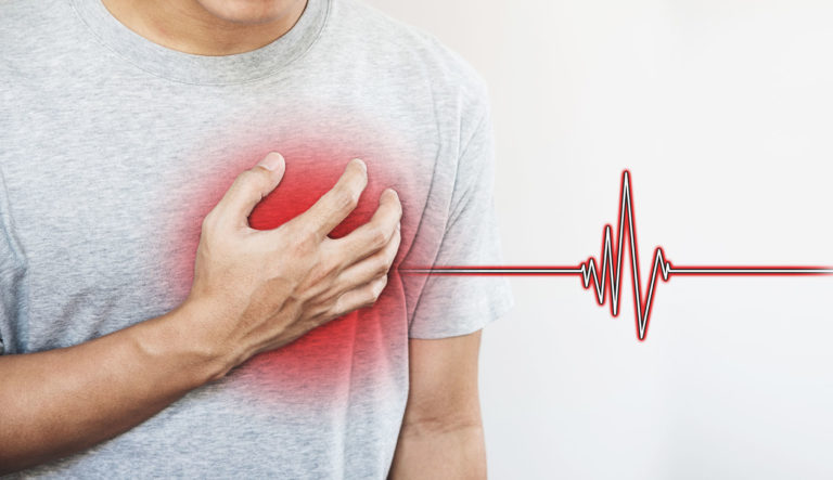 HEART PROBLEMS IN GENERAL