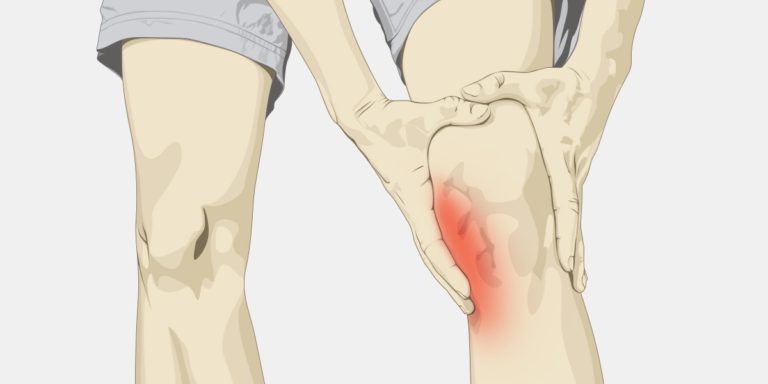 KNEE-PAIN