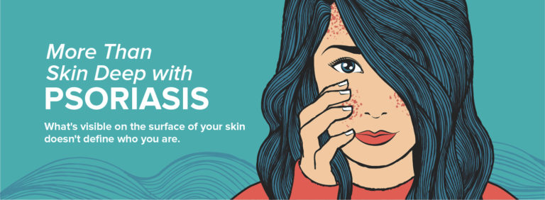 PSORIASIS