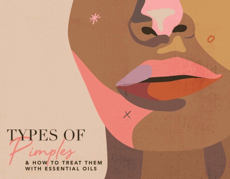 PIMPLES