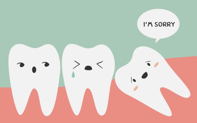 WISDOM TEETH