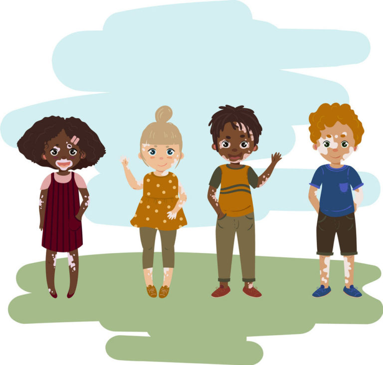Vitiligo skin disease
