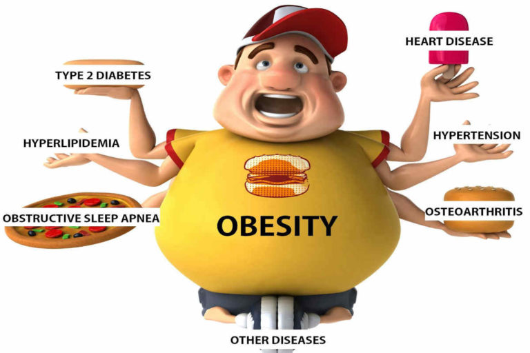 OVERWEIGHT