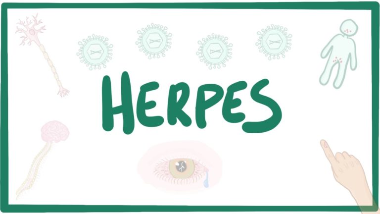 HERPES