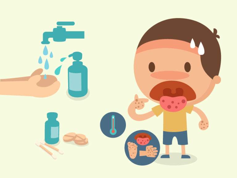 MOUTH INFECTION VIRUS