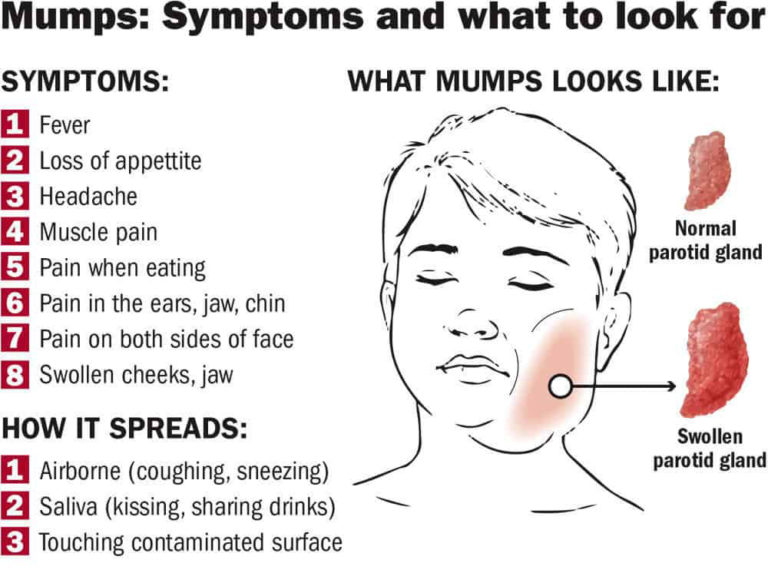 MUMPS