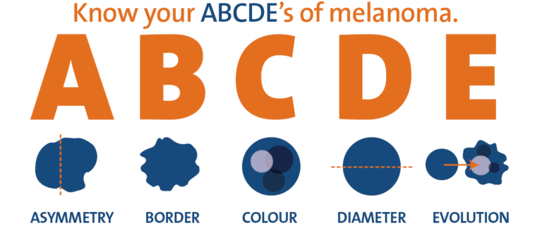 SKIN-CANCER