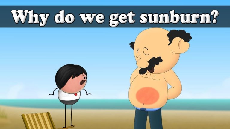 SUNBURN