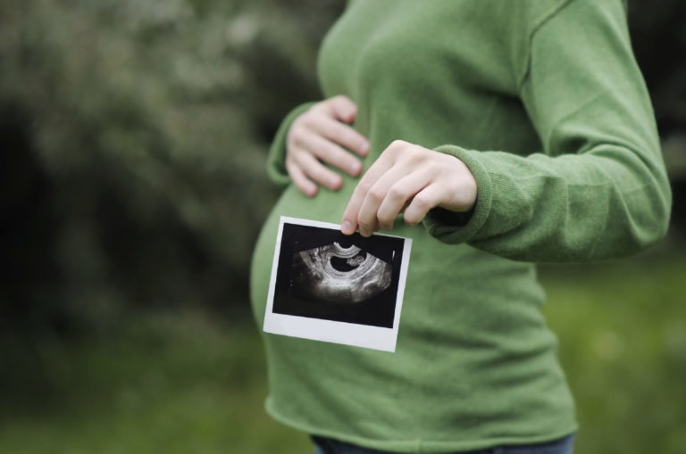 ULTRASOUND (SCAN)